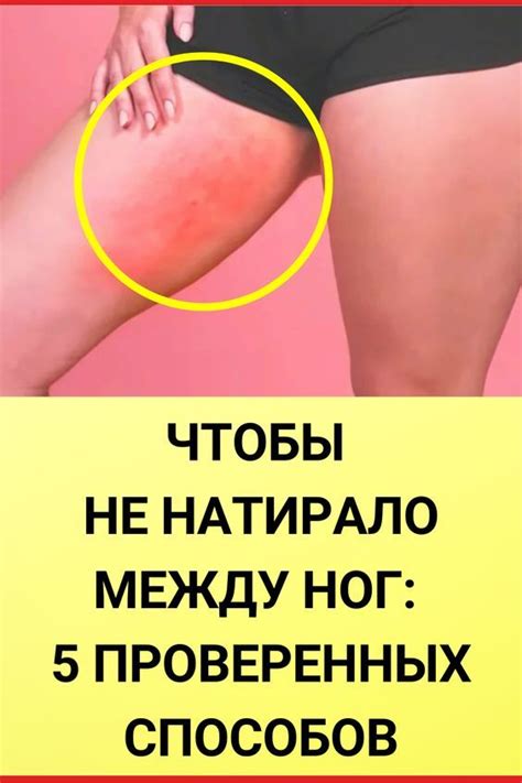 Чтобы не натирало между ног: 5 проверенных способов Чтобы не натирало ...