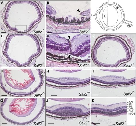 Histological Analysis Of Eyes Dissected From P Sall Mice Top