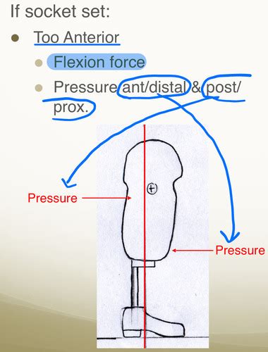 Prosthetic Biomechanics Gait Flashcards Quizlet