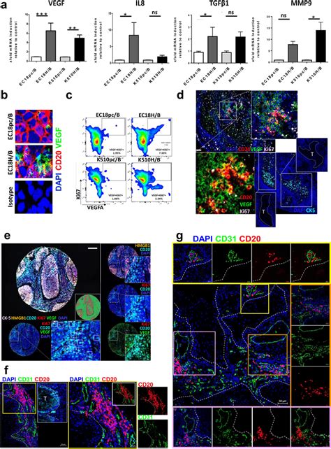 Tumor Derived HMGB1 Drives B Cells Toward A Proangiogenic Profile A