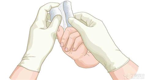 Does it hurt to remove stitches after the operation? This is the right way to nurse the surgical ...