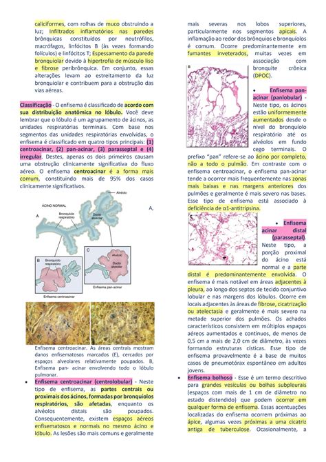 SOLUTION Doenc As Pulmonares Inflamato Rias Studypool