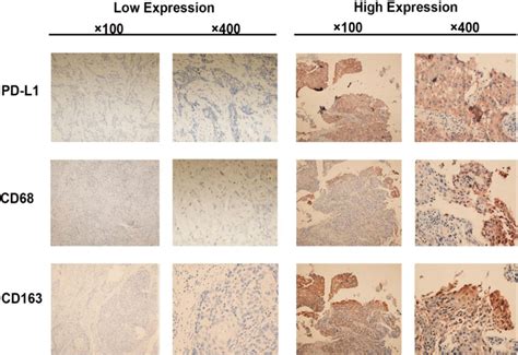 Immunohistochemistry Staining For Pd L1 Cd68 And Cd163 Expression In Download Scientific