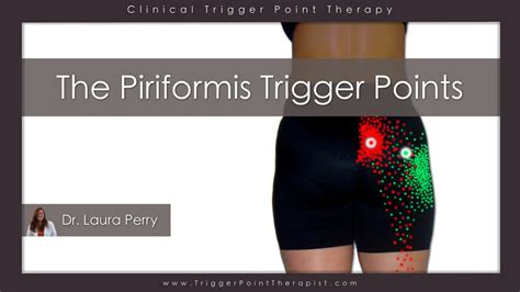 Piriformis Trigger Points: Double Trouble | TriggerPointTherapist.com