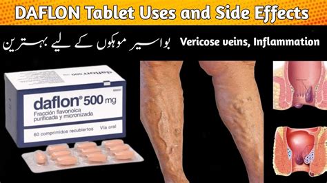 Daflon Tablet Uses And Side Effects In Urdu Hindi Daflon 500 Mg Tablet For Hemorrhoids Youtube