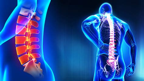 The Evolution Of Laser Spine Treatment