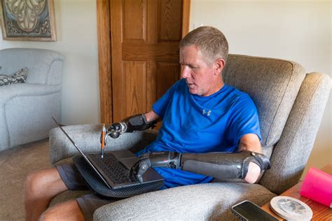 Life Hacks For People With An Upper Limb Difference