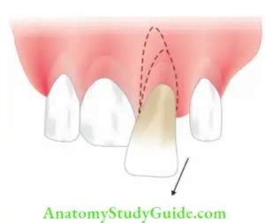 Luxation Injuries Treatment Notes - Anatomy Study Guide