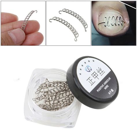 12pcs Ingrown Toe Nail Correction Wire Fixer Pedicure Paronychia