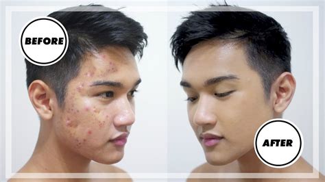 How To Cover Mens Acne And Scars Mens Makeup Tutorial Youtube