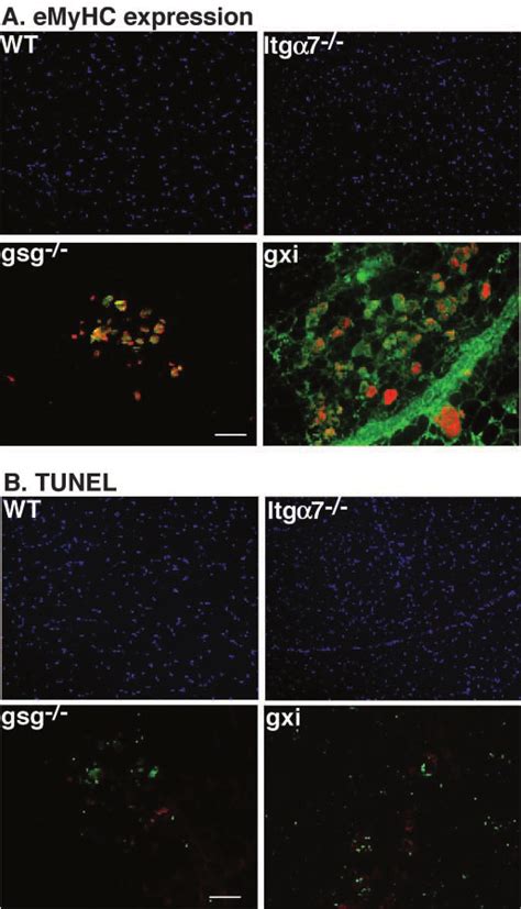 Upregulation Of Embryonic Myosin Heavy Chain Expression In Gxi Mouse Download Scientific