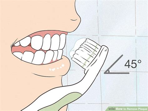 how to remove build up plaque at home