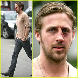 Ryan Gosling Gets A Black Eye | Ryan Gosling : Just Jared