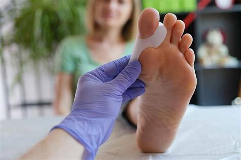 Hallux valgus quand se faire opérer Chirurgie du pied l COT EST