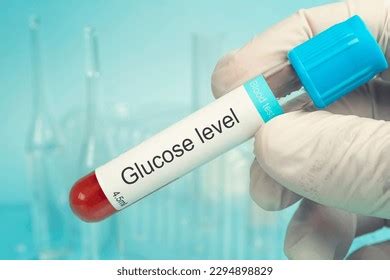 Scientist Hold Sample Tube Glucose Test Stock Photo 2294898829 | Shutterstock