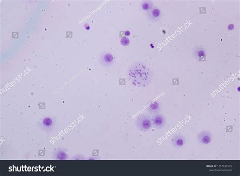 Chromosomes Human Under Microscope Education Lab Stock Photo 1257635569 ...