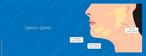 Parotid Gland Sialadenitis Bacterial Infection Sialolithiasis Blockage