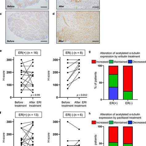 Expression Of Acetylated Tubulin In Clinical Specimens The