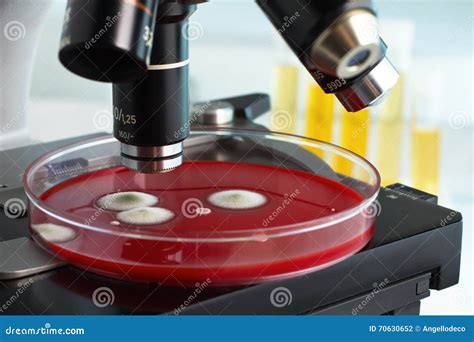 Petri Plate Under in the Laboratory Microscope Stock Photo - Image of medicine, examination ...