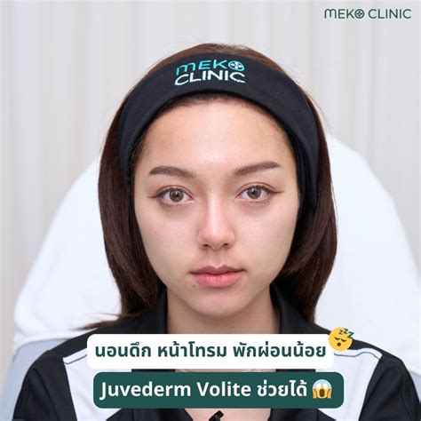 Meko Glass Skin ผิวสุขภาพดี เรียบเนียน เปล่งประกายราวกับมีน้ำอยู่ใต้ผิว