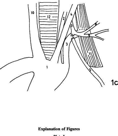 The Variations Of The Subclavian Artery And Its Branches Semantic Scholar