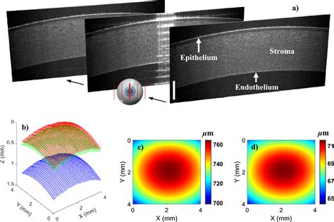 Ex Vivo 3D Porcine Corneal Imaging Using The Low Cost LF FD OCT System