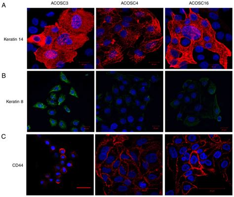 Establishment And Characterization Of Novel Human Oral Squamous Cell