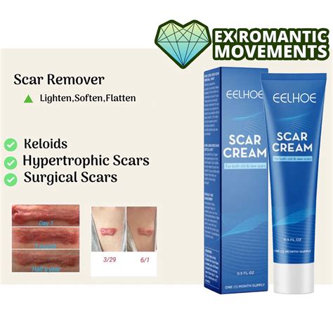 Pangtanggal Ng Peklat Scar Remover Scar Removal Cream Scarminator Cream