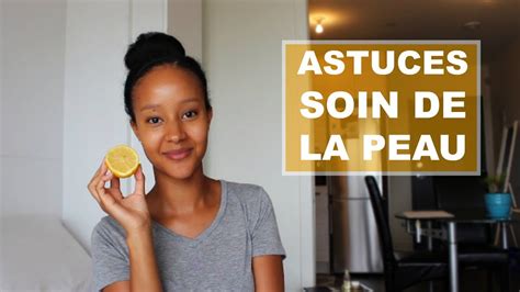 ♡astuces Soin De La Peau♡ Boutons Et Taches Youtube