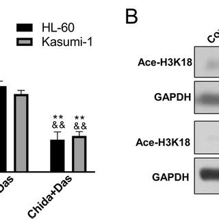 Chidamide Synergized With Dasatinib In Inhibiting The Proliferation Of