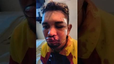 Venezuela El Violinista De Las Protestas Resulta Herido En El Rostro