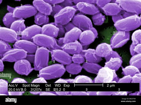 Sem Of Anthrax Bacteria Spores Bacillus Anthracis Stock Photo Alamy