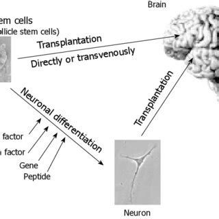 Transplantation of somatic stem cells into the central nervous system.... | Download Scientific ...