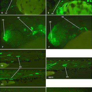 Expression Patterns Driven By Zebrafish And Mouse Syntenic Ecrs With