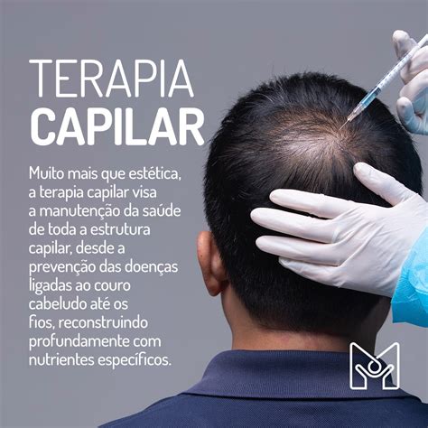 Terapia Capilar Instituto Melo