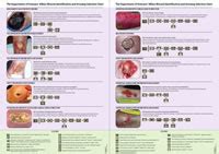 Wound Classification Chart Nhs Ponasa