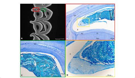 FIGURE Histological appearance of infundibular structures. (A) A ...