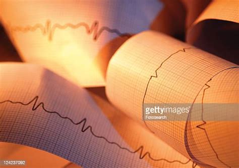 38 Ecg Graph Stock Photos High Res Pictures And Images Getty Images