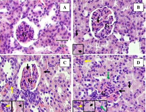 Ekspresi Interleukin 1 Beta Il 1Β Dan Gambaran Histopatologi Ginjal