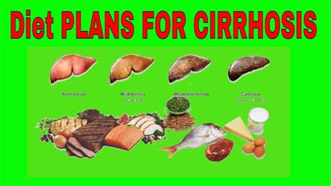 🔥🔥 Diet PLANS FOR CIRRHOSIS of the Liver | Liver disease diet, Cirrhosis diet, Liver diet recipes