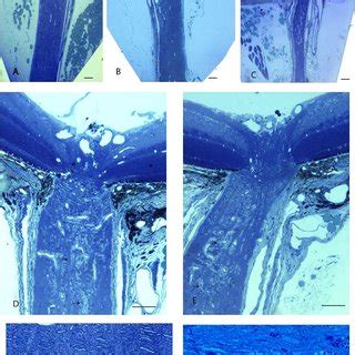 Optic nerve histology. Longitudinal sections of the retrobulbar optic... | Download Scientific ...