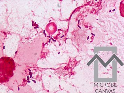 Enterobacter Cloacae Gram Stain