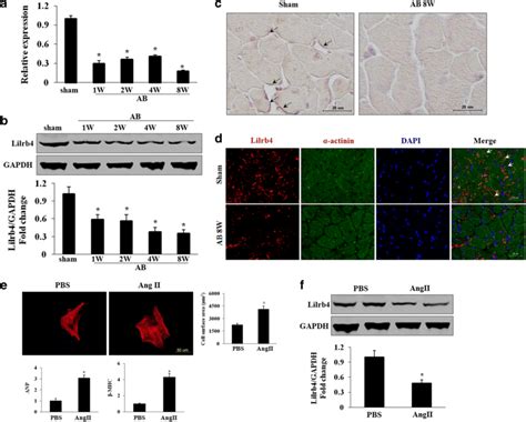 Lilrb4 Was Downregulated In Hypertrophic Hearts And Cardiomyocytes A