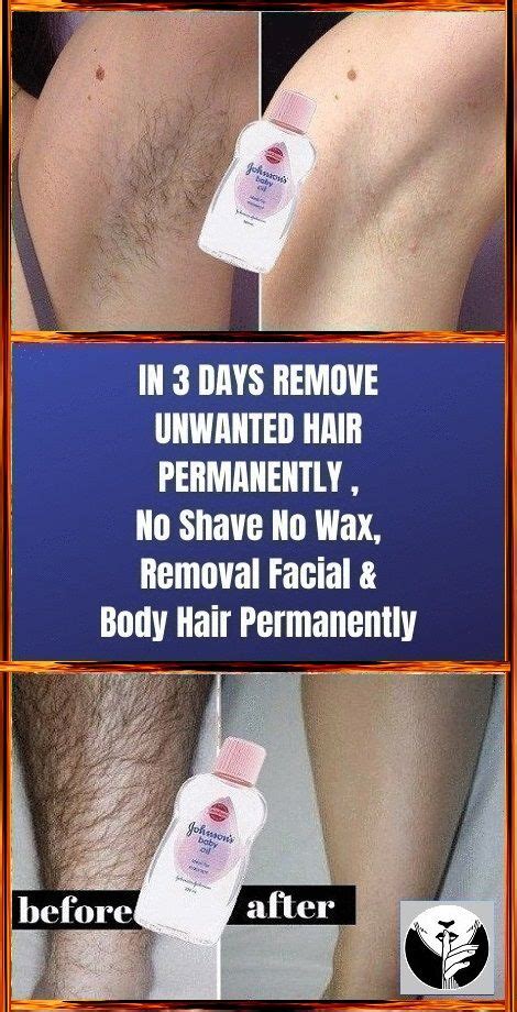 Remove Unwanted Hair Permanently In Three Days No Shave No Wax