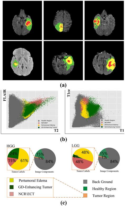 Challenges in segmentation of brain glioma tumors. a Shows glioma tumor ...