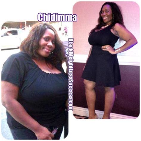 Chidimma Lost 94 Pounds Black Weight Loss Success