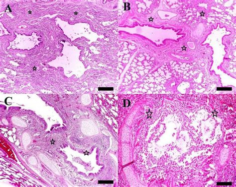 Microscopic appearance of lung lesions H E stain Bar 100 µm