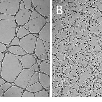 In Vitro Capillary Like Tubule Formation Assay Representative Images