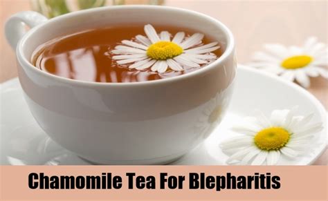 5 Home Remedies For Blepharitis Natural Home Remedies And Supplements