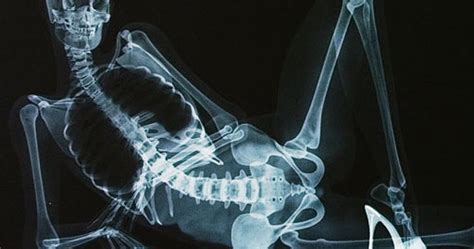 XXX X Ray Pictures Naked Anatomy Lesson Shocks Senses CBS News